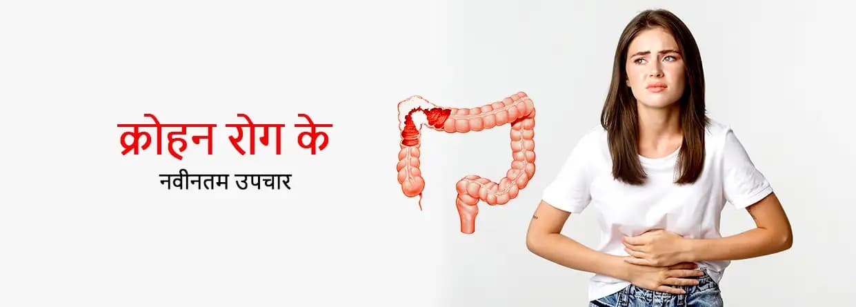 क्रोहन रोग का नवीनतम उपचार