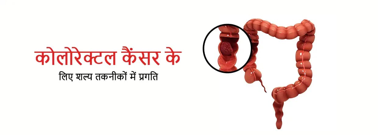 कोलोरेक्टल कैंसर के लिए शल्य तकनीकों में प्रगति