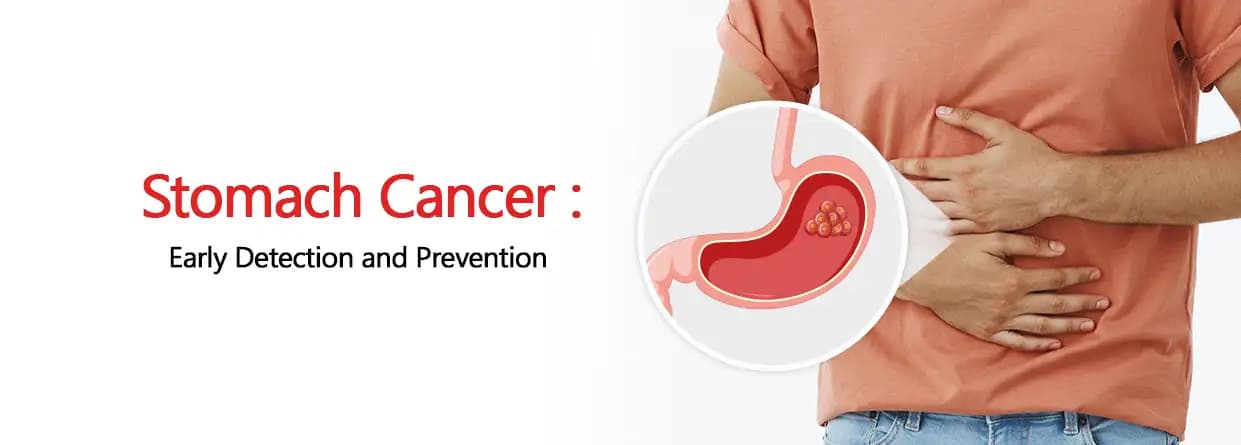 Stomach Cancer: Early Detection and Prevention