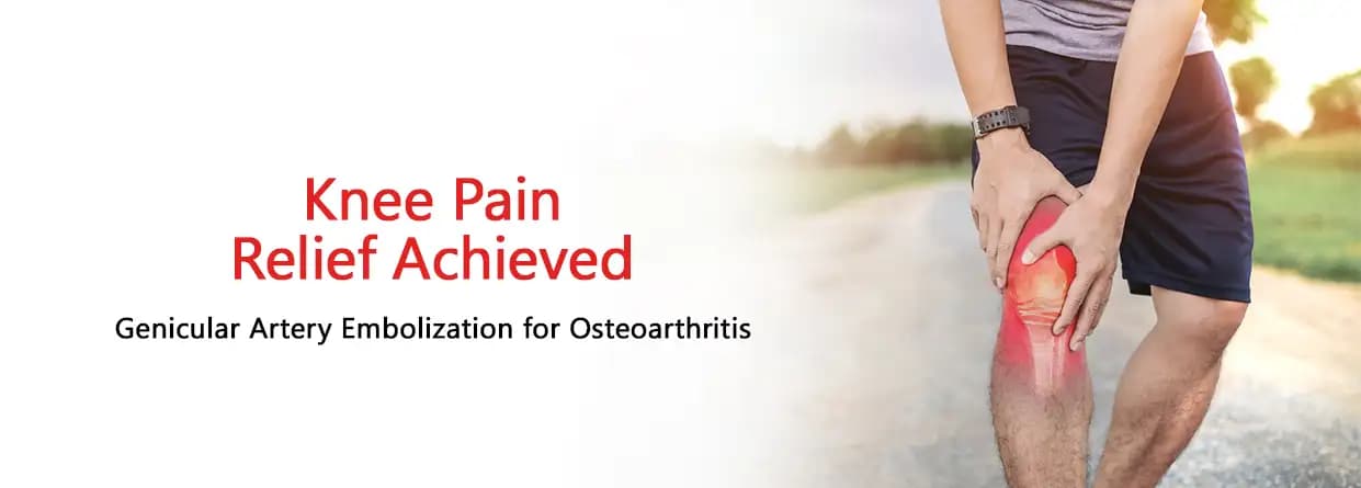 Knee Pain Relief Achieved - Genicular Artery Embolization for Osteoarthritis
