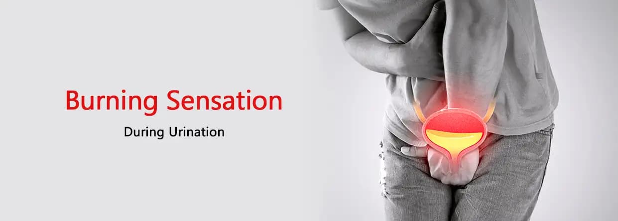 Burning Sensation During Urination
