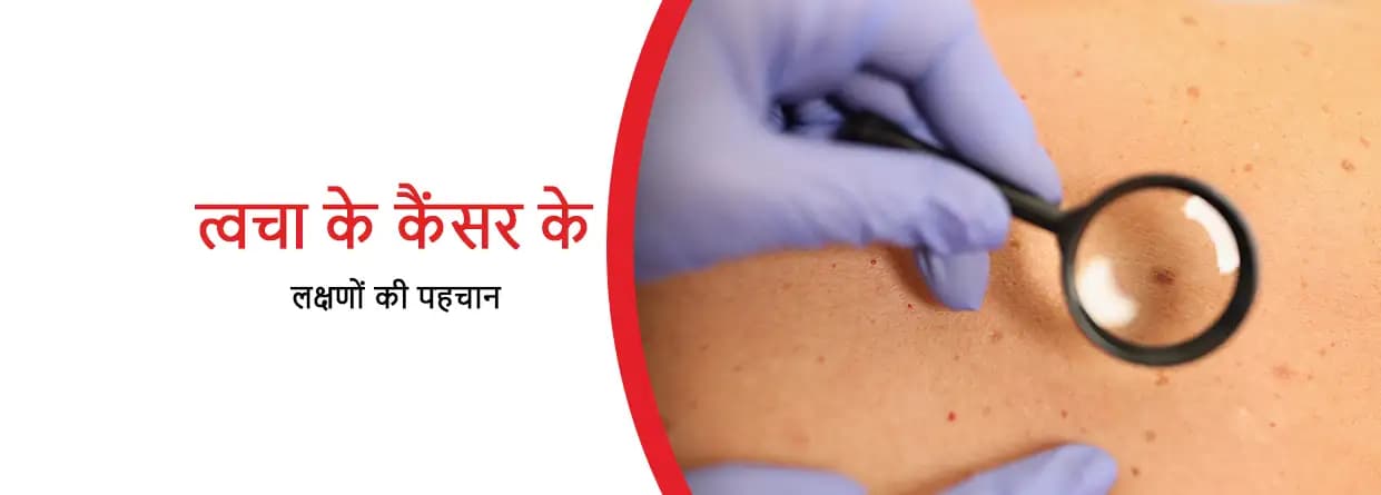 त्वचा के कैंसर के लक्षण पहचानना