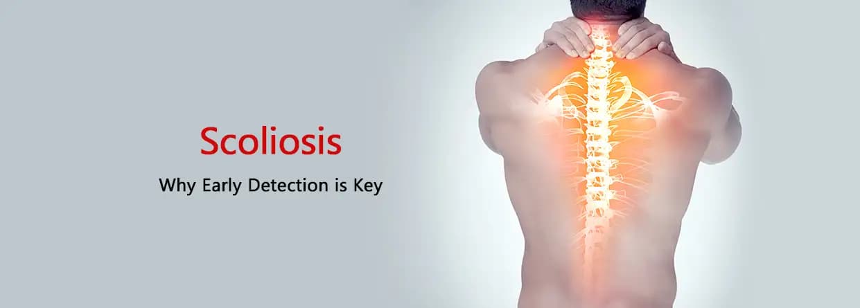 Scoliosis: Why Early Detection is Key