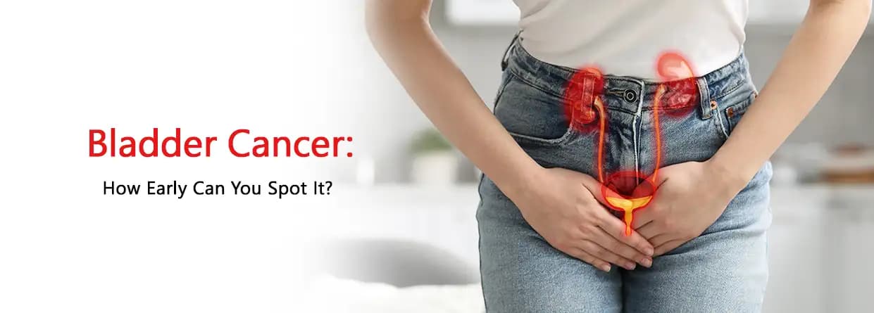 Bladder cancer: How Early Can You Spot It?
