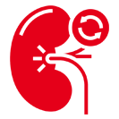 Kidney transplants