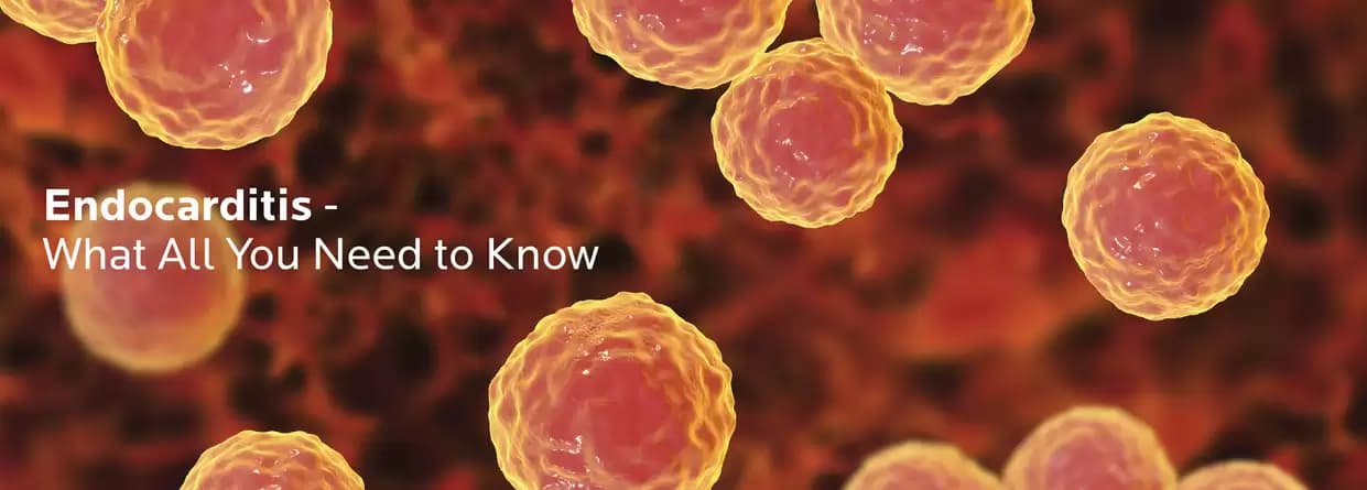 Endocarditis - What All You Need to Know