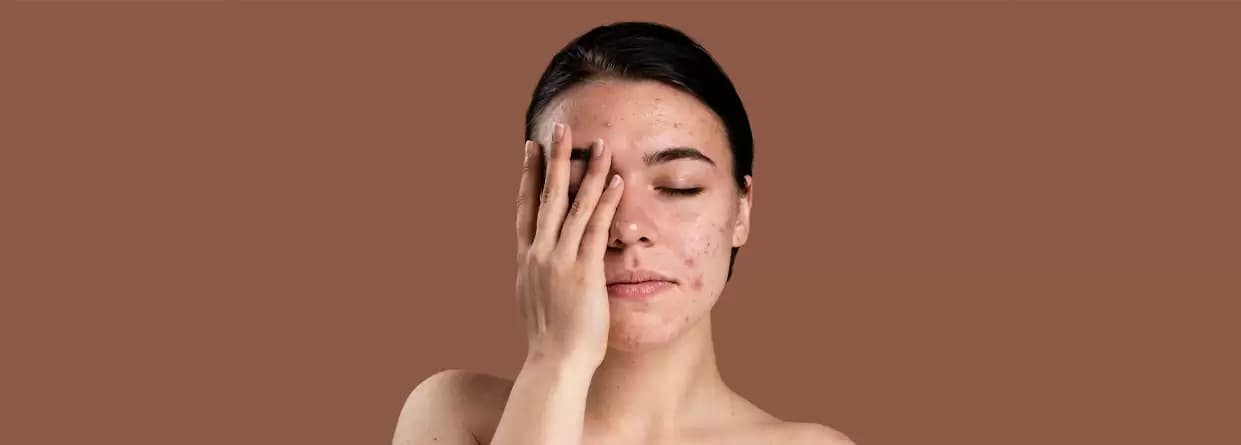 What causes skin cancer and how can it be prevented?