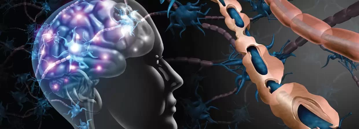 What All You Should Know About Multiple Sclerosis?