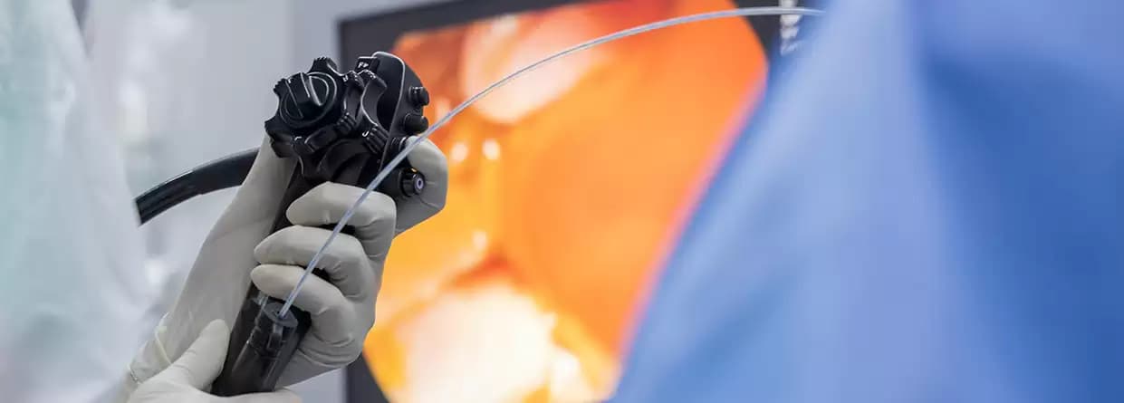 Endoscopic Retrograde Cholangio-Pancreatography (ERCP)