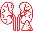 Kidney Transplant