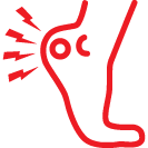Plantar Fasciitis
