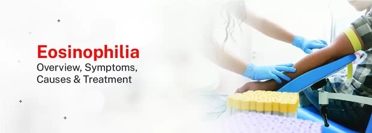 Eosinophilia: Overview, Symptoms, Causes & Treatment