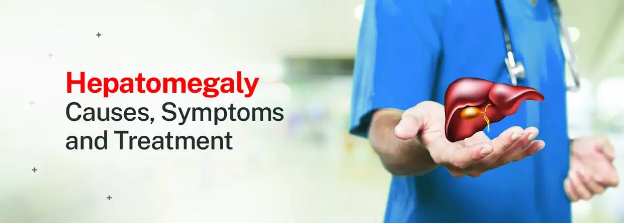 Hepatomegaly: Causes, Symptoms, and Treatment