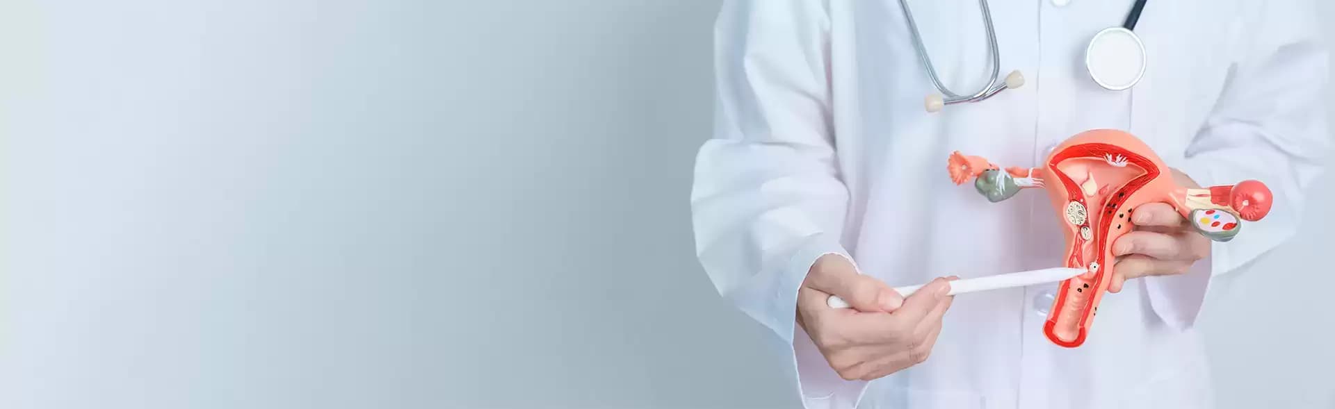 Myomectomy Treatment