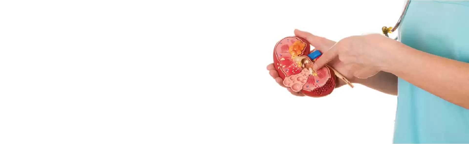 Kidney Stone Treatment