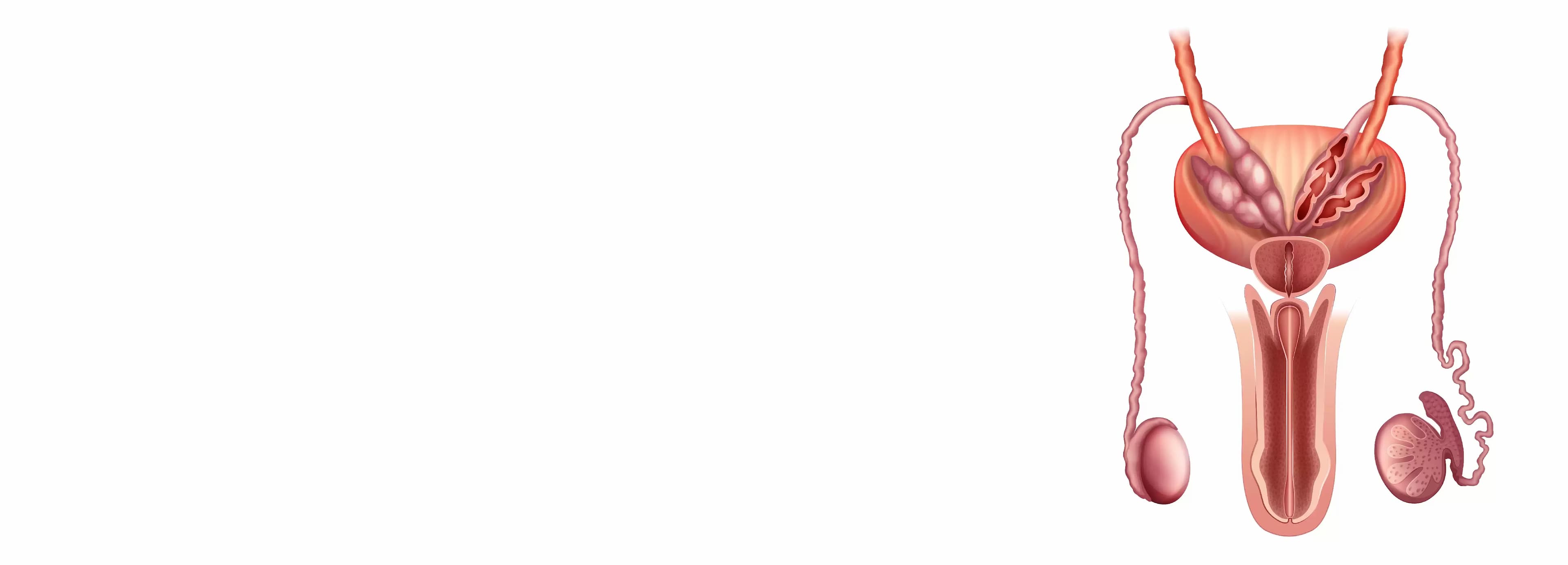 Varicocele Treatment