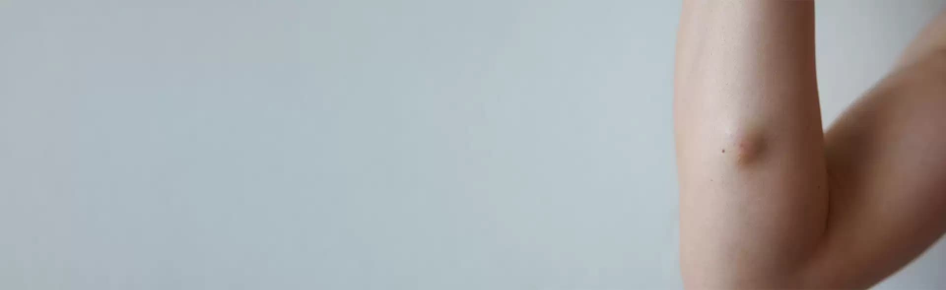 Sebaceous Cyst Surgery