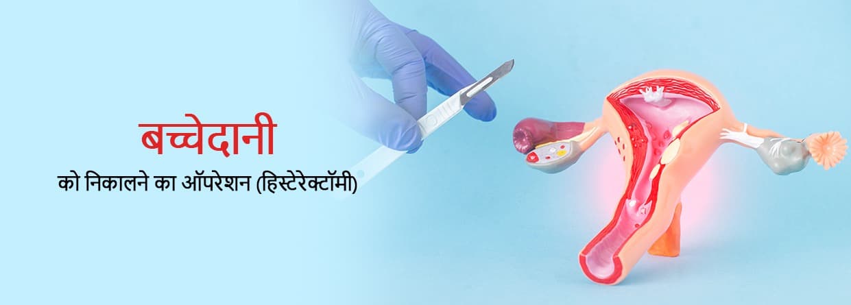 बच्चेदानी को निकालने का ऑपरेशन (हिस्ट्रेक्टरेक्रॉमी)