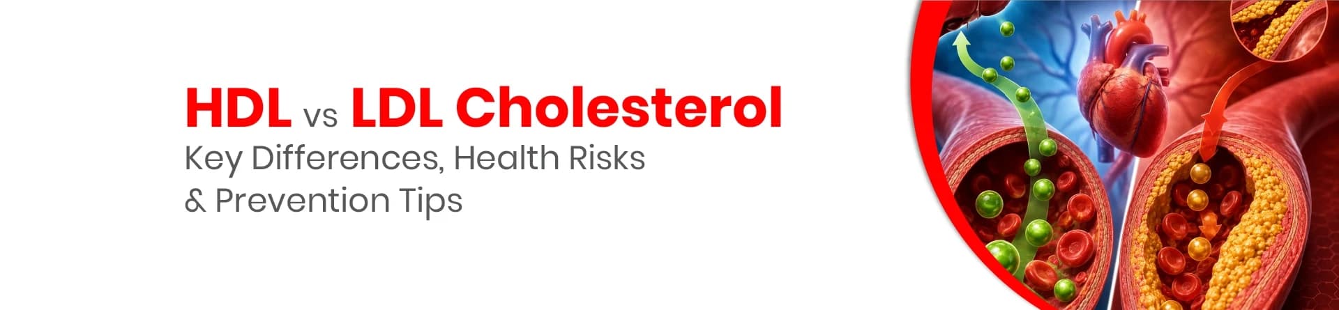 HDL vs LDL Cholesterol: Key Differences, Health Risks & Prevention Tips