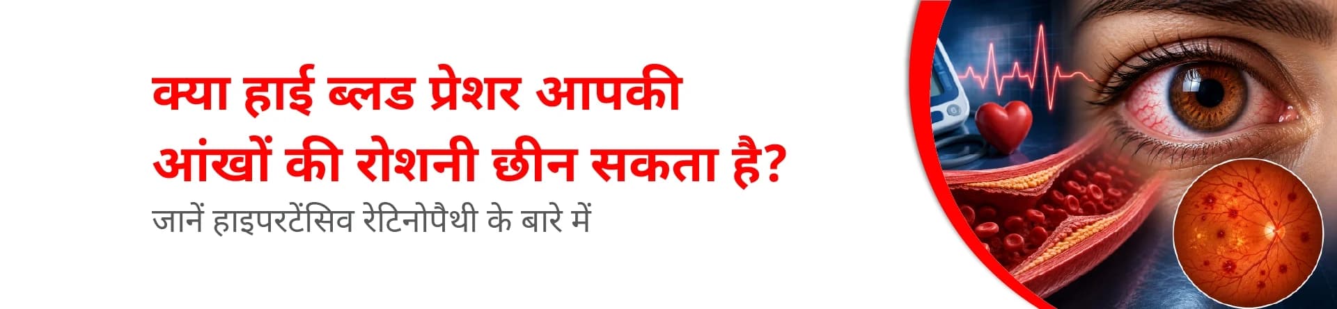क्या हाई ब्लड प्रेशर आपकी आंखों की रोशनी छीन सकता है? जानें हाइपरटेंसिव रेटिनोपैथी के बारे में