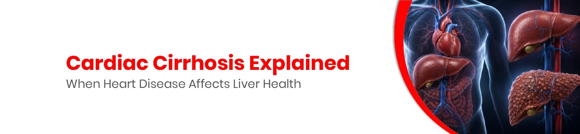 Cardiac Cirrhosis Explained: When Heart Disease Affects Liver Health