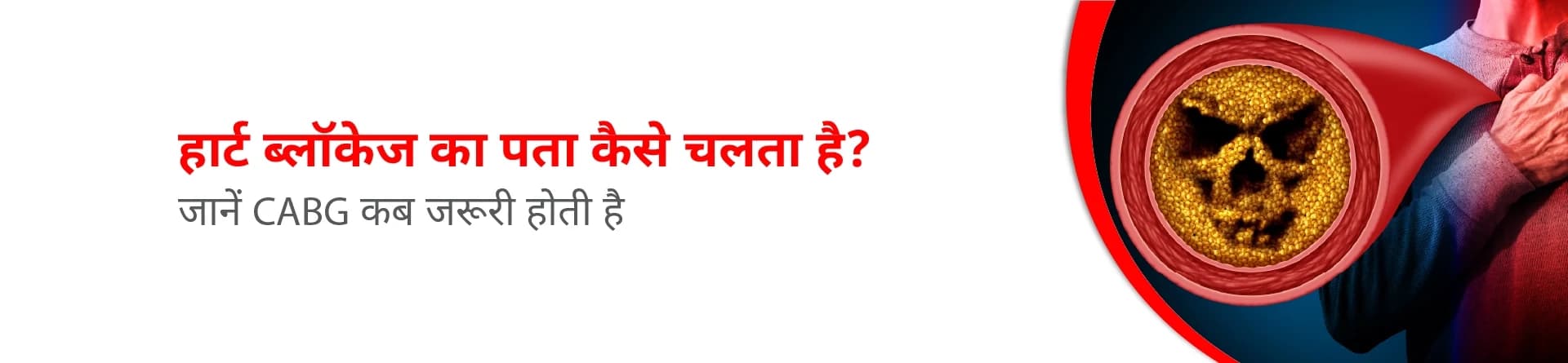 हार्ट ब्लॉकेज का पता कैसे चलता है? जानें CABG कब जरूरी होती है