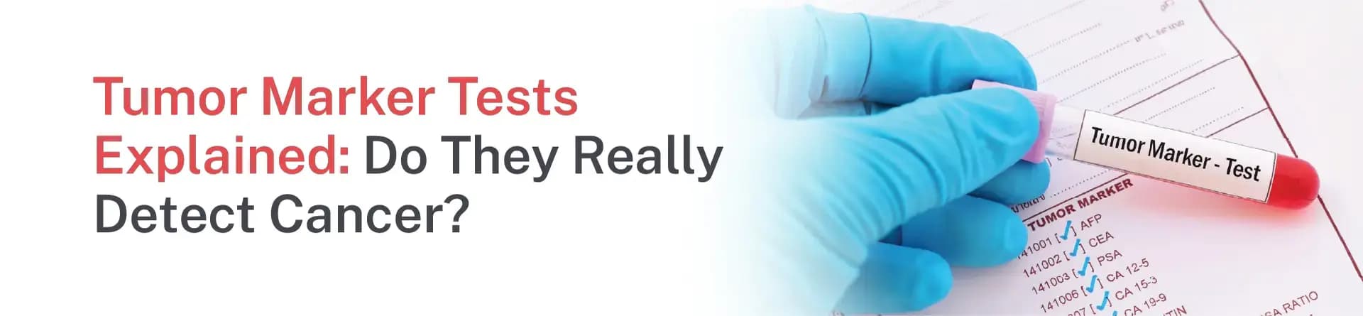 Tumor Marker Tests Explained: Do They Really Detect Cancer?