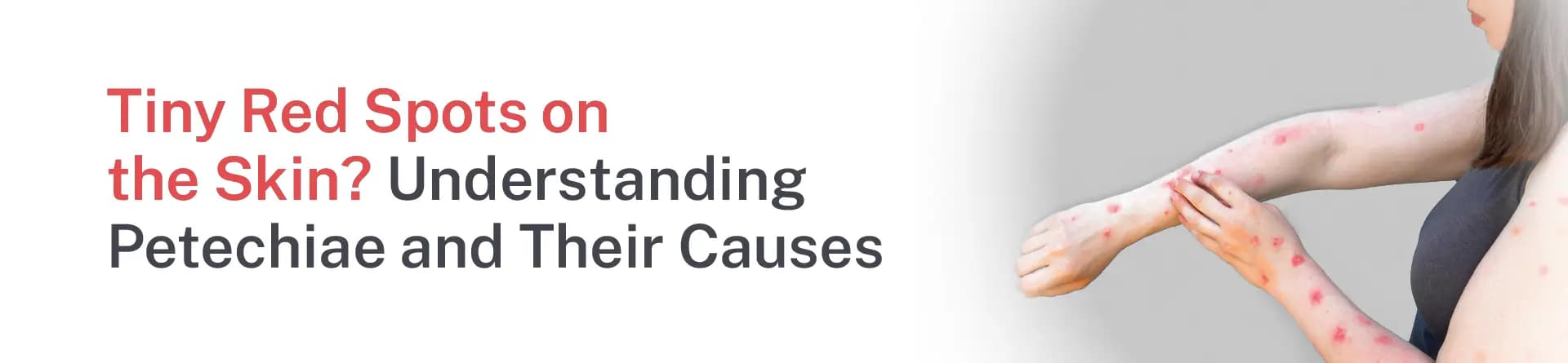 Tiny Red Spots on the Skin? Understanding Petechiae and Their Causes