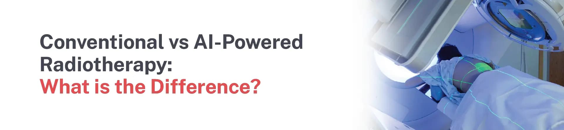 Conventional vs AI-Powered Radiotherapy: What Is the Difference?