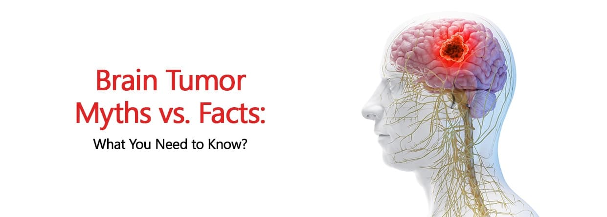 Brain Tumor Myths vs. Facts: What You Need to Know