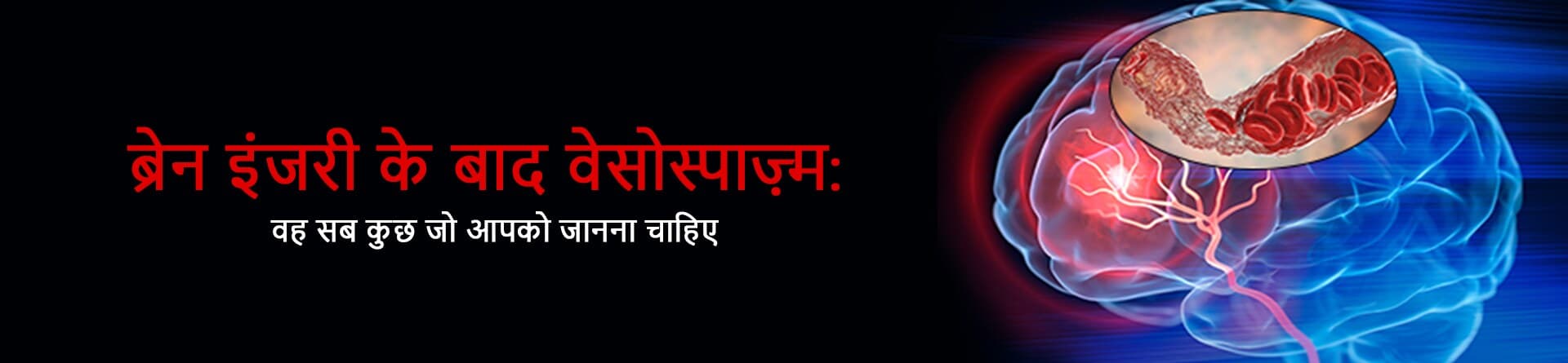 ब्रेन इंजरी के बाद वेसोस्पाज़्म: वह सब कुछ जो आपको जानना चाहिए