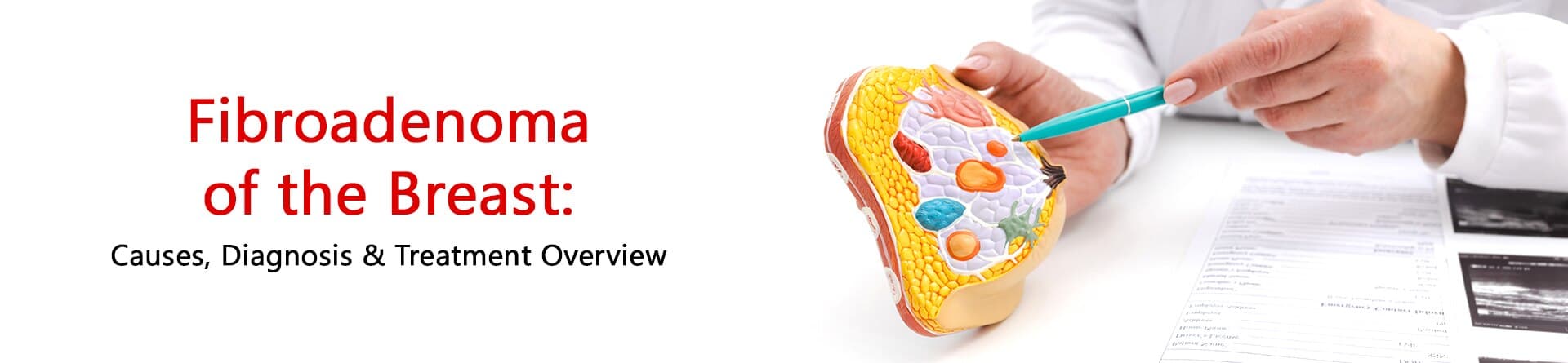 Fibroadenoma of the Breast: Causes, Diagnosis & Treatment Overview