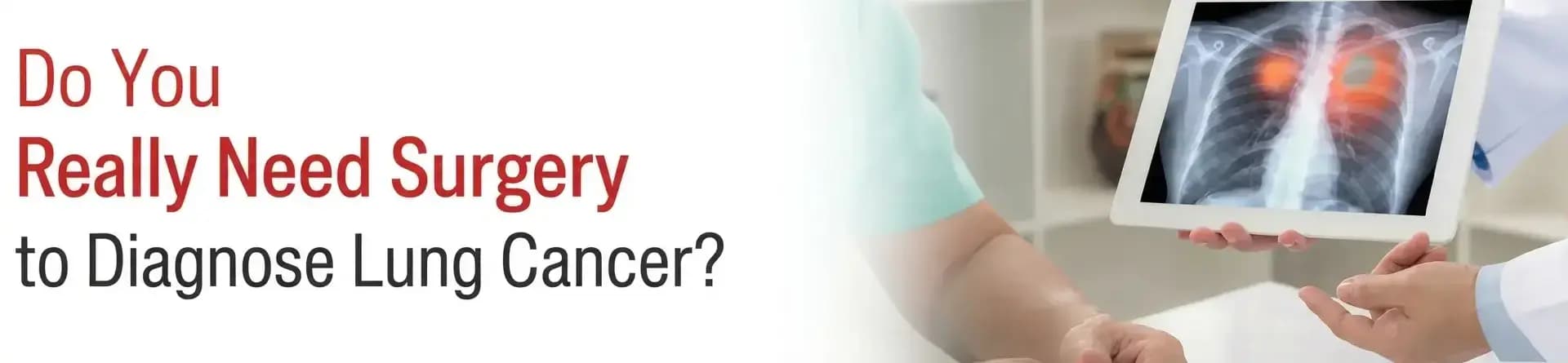 Do You Really Need Surgery to Diagnose Lung Cancer?