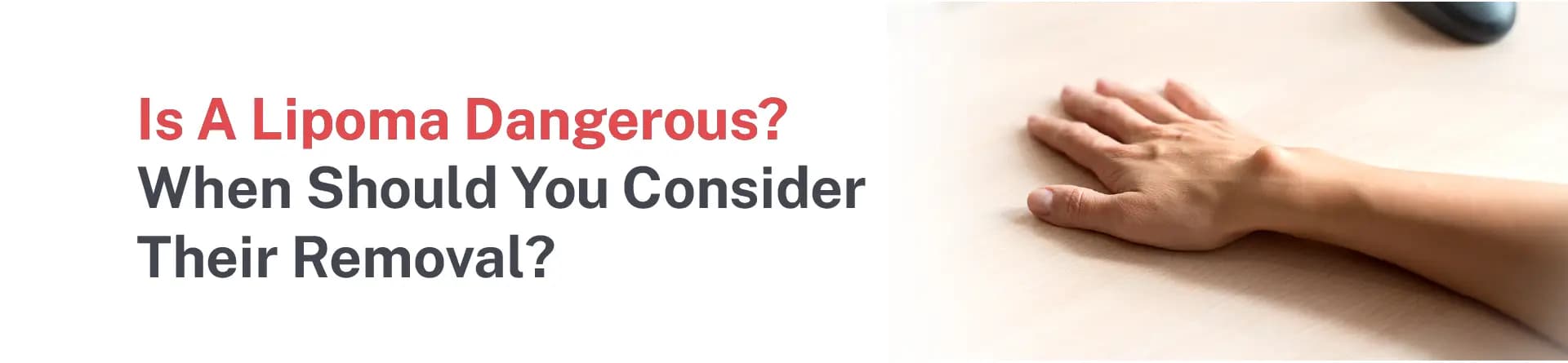 Is a Lipoma Dangerous? When Should You Consider their Removal?