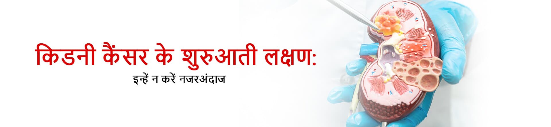 किडनी कैंसर के शुरुआती लक्षण: इन्हें न करें नज़रअंदाज़