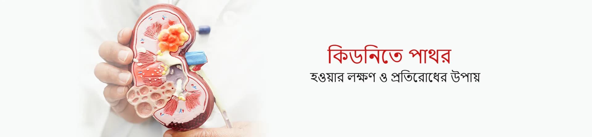 কিডনিতে পাথর হওয়ার লক্ষণ ও প্রতিরোধের উপায়