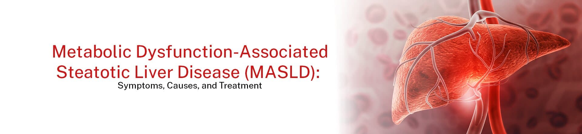 Metabolic Dysfunction-Associated Steatotic Liver Disease (MASLD): Symptoms, Causes, and Treatment