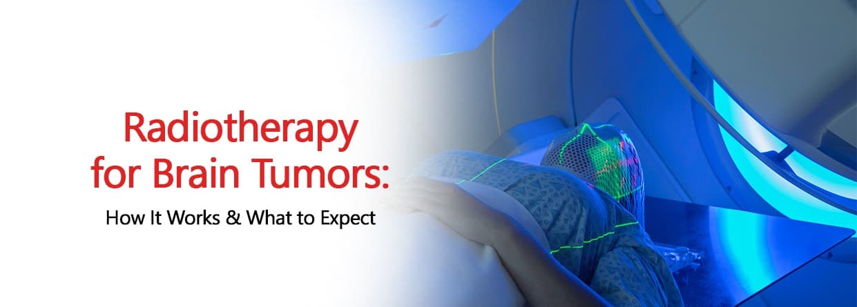 Radiotherapy for Brain Tumors: How It Works & What to Expect