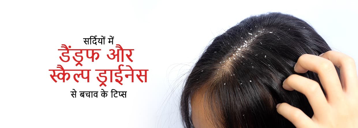 सर्दियों में डैंड्रफ और स्कैल्प ड्राईनेस से बचाव के टिप्स