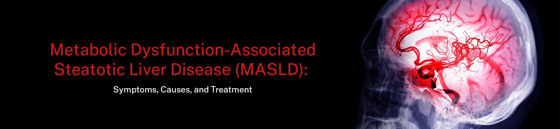 What Causes an Ischemic Stroke and Can It Be Prevented?