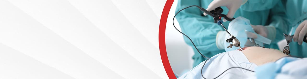 Bariatric Surgery
