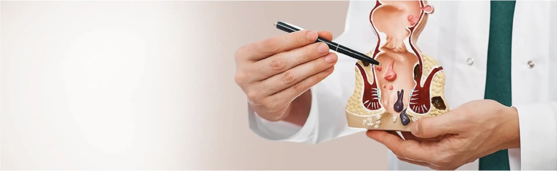 Anal Fissure Surgery