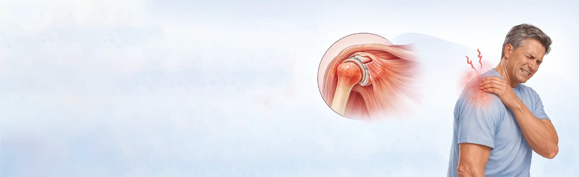 Frozen Shoulder Treatment