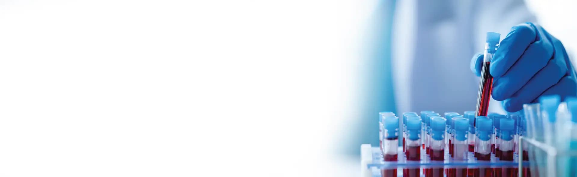 Liquid Biopsy