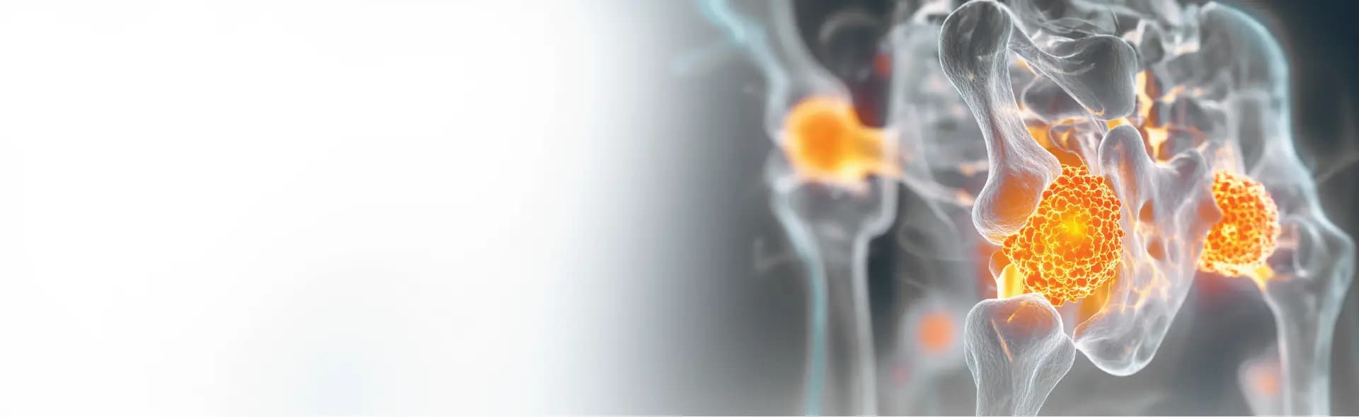 Thyroid Cancer treatment