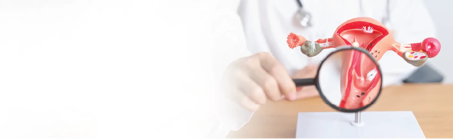 Fibroid treatment