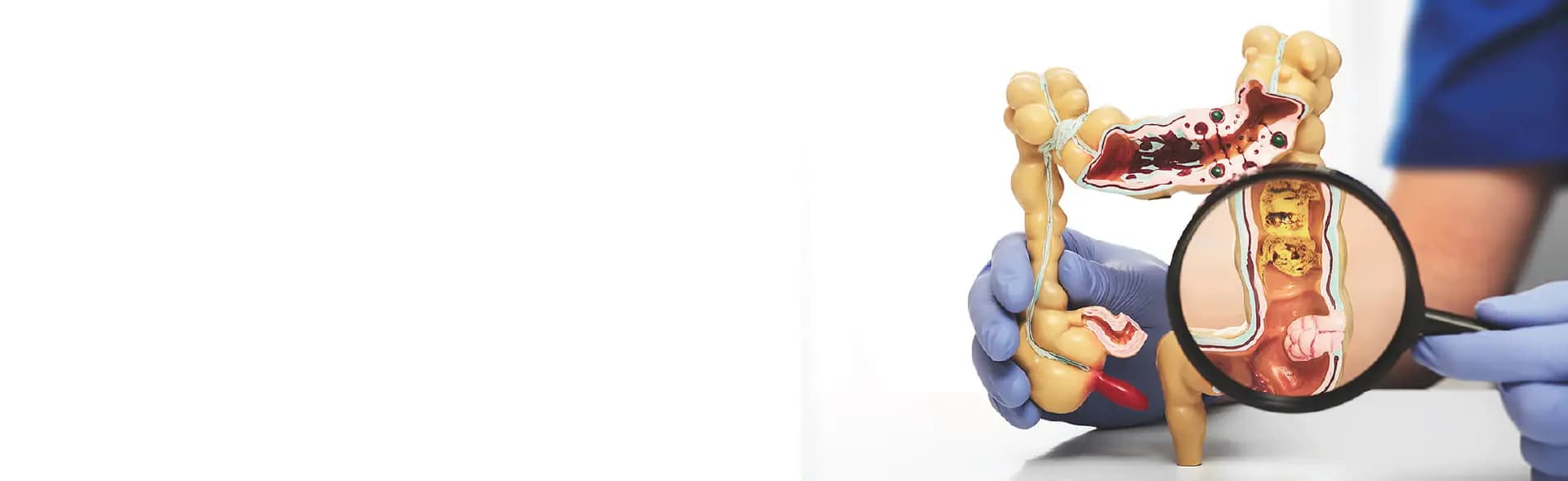 Colorectal/GI Cancer Surgery