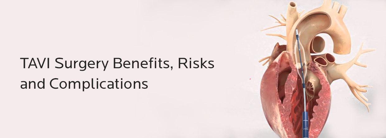 TAVI Surgery Benefits, Risks and Complications