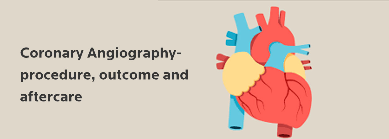 Coronary Angiography- All You Need to Know