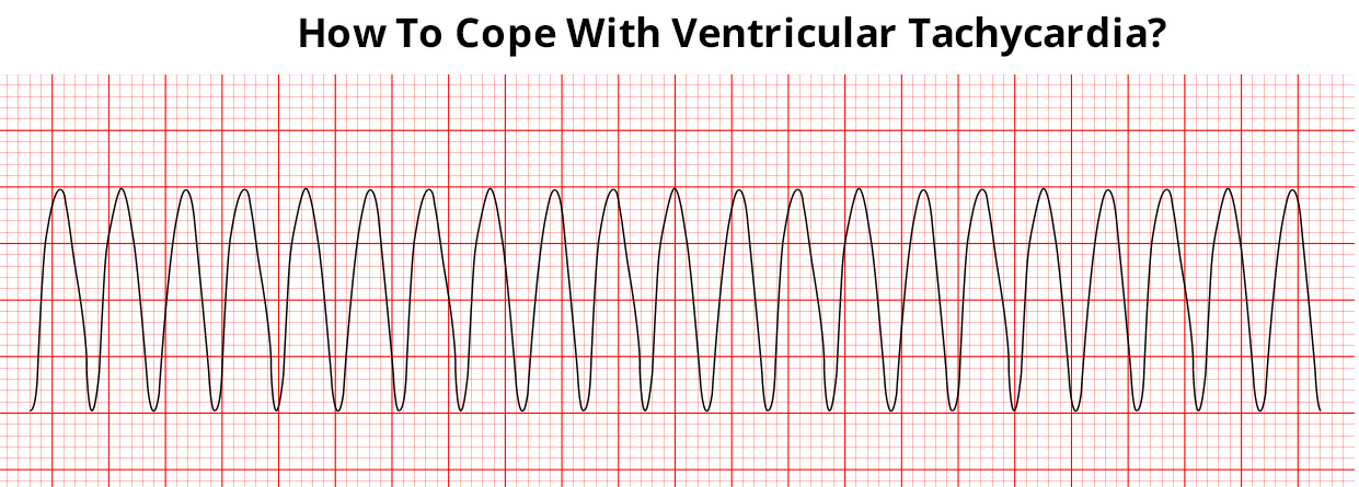 How To Cope With Ventricular Tachycardia?